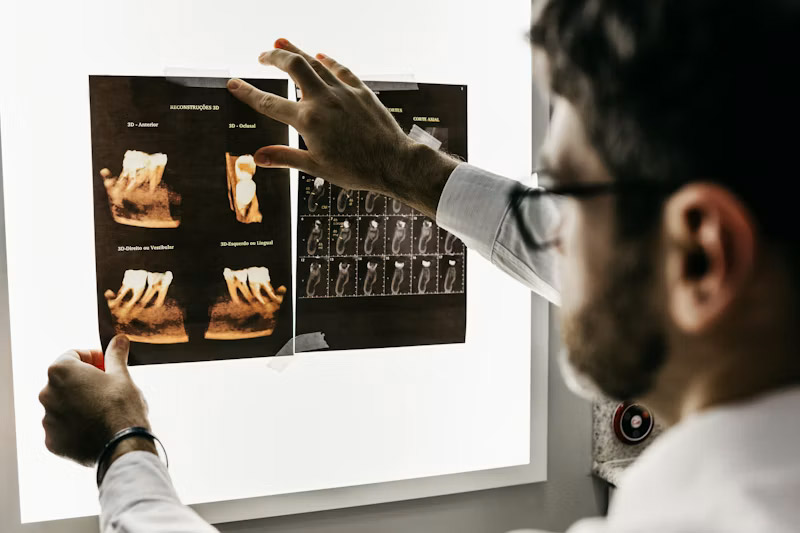 Dental implant procedure setup — premium Delhi clinic